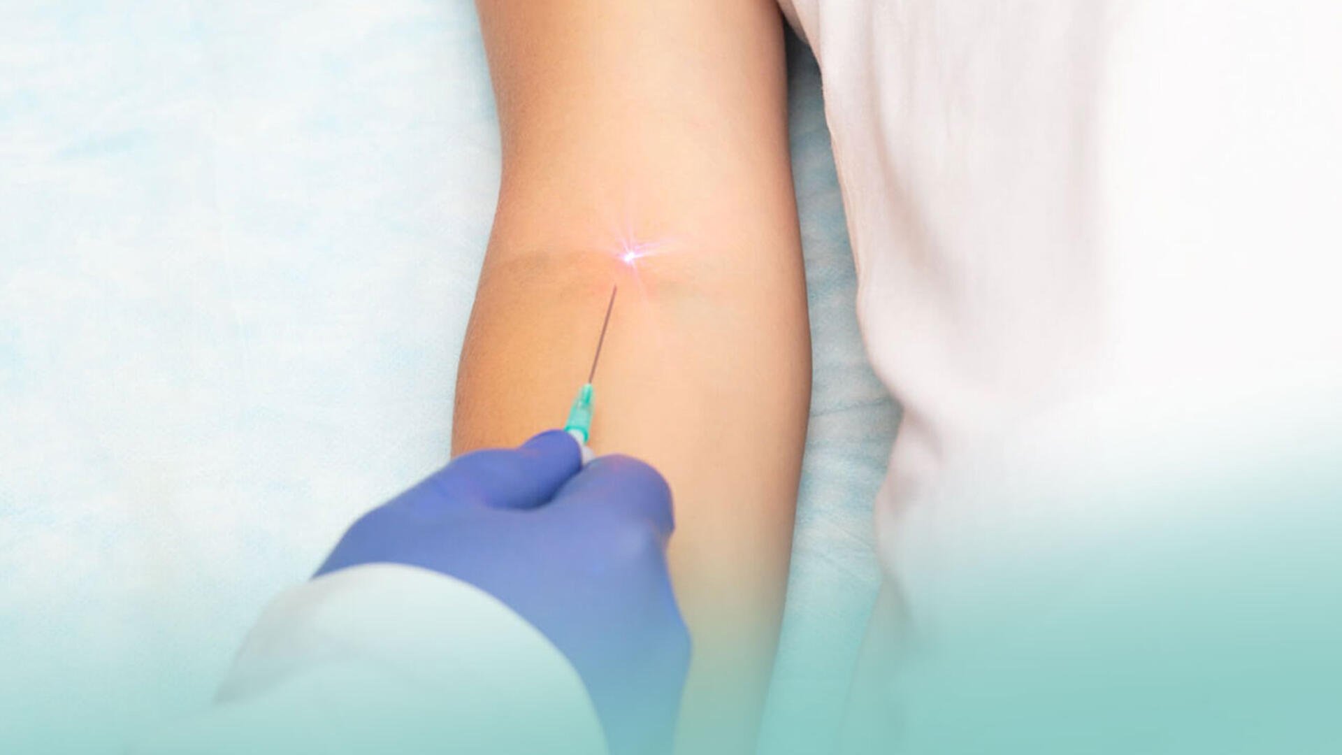 Die intravenöse LowLevelLasertherapie DOCTARIS