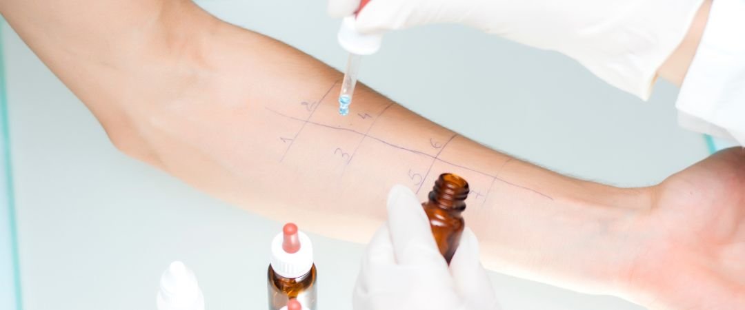Lebensmittelallergien und Darmmikrobiom