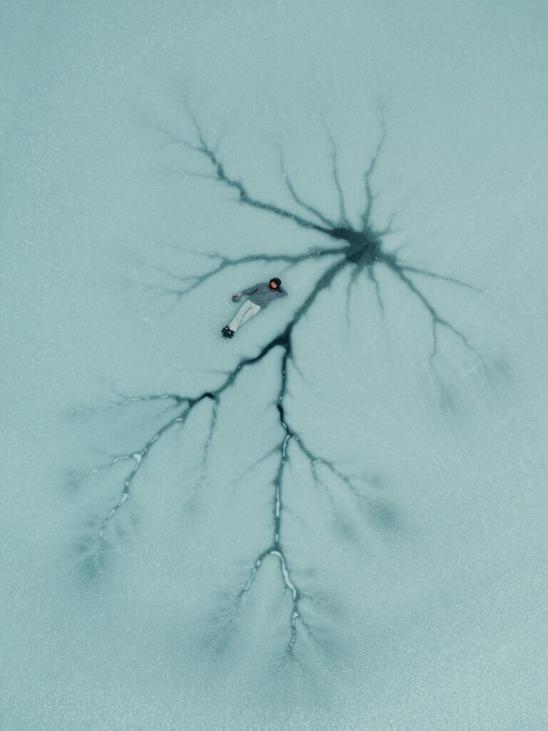 neurometabolismus