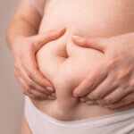 fat female belly, woman holding skin to check cellulite. flabby skin on a fat belly, plastic surgery concept on gray background
