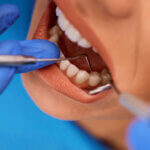 indikation parodontitis