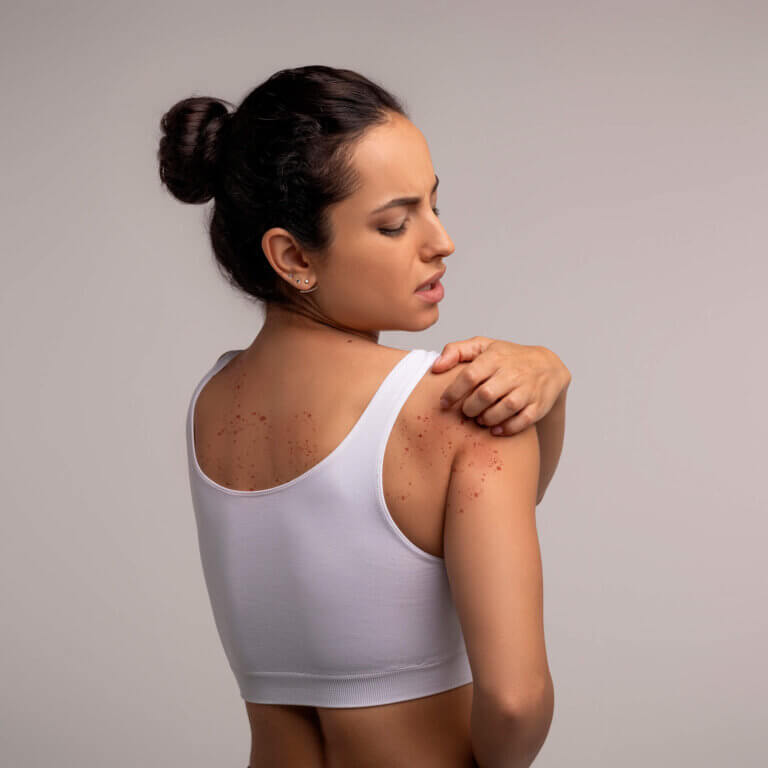 indikation histaminintoleranz